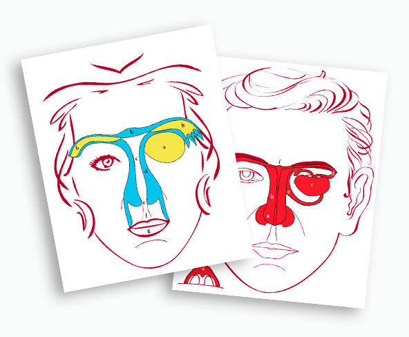 schéma de réflexion des gonades